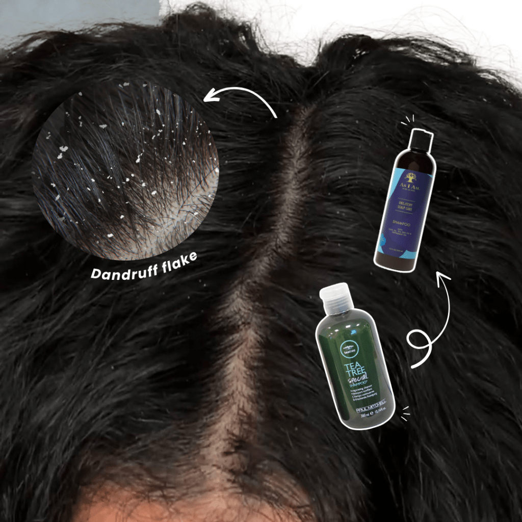 The BEST Products to Relieve Dandruff and an Itchy&nbsp;Scalp